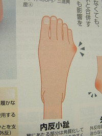 足の小指の形に注意！