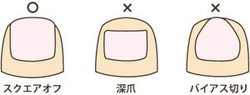 足の爪 足の爪